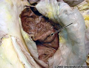 <p>what structure in the large intestine is this (be specfic)?</p>