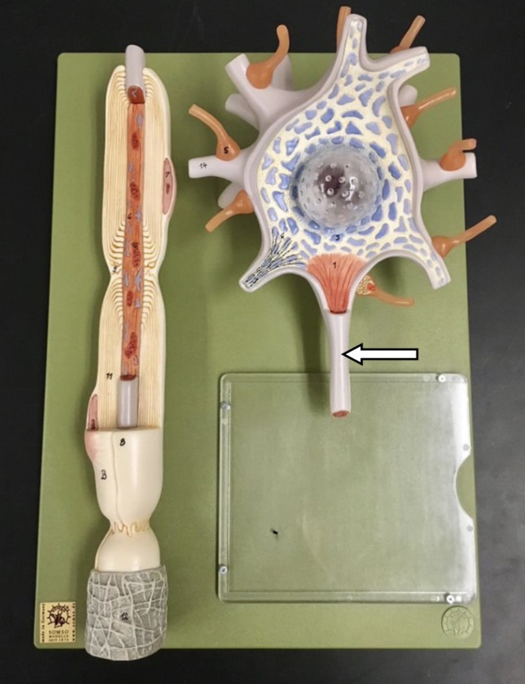 <p>What is the arrow pointing to?</p>