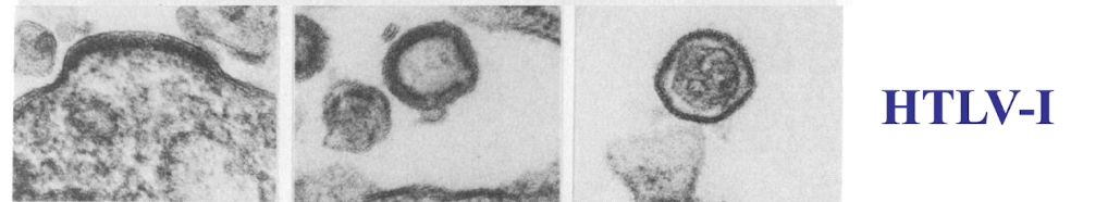 <ul><li><p><strong>Morphology is similar to HIV</strong>, featuring a spherical shape with a lipid envelope.</p></li><li><p><strong>Contains two single strands of RNA and essential proteins</strong>, including the enzyme reverse transcriptase.</p></li><li><p>Characterized by a <span style="color: green;"><strong>distinct immunodominant protein</strong></span> that <strong>helps in immune evasion and pathogenesis. </strong></p></li></ul><p></p>