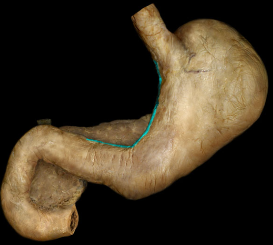 term image