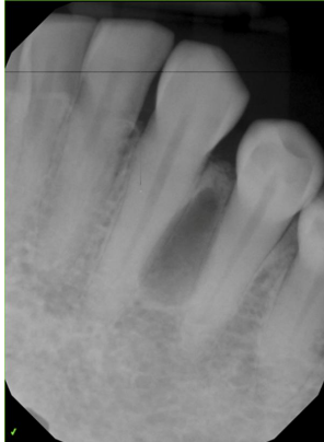 <p>Provide two differential diagnosis</p>