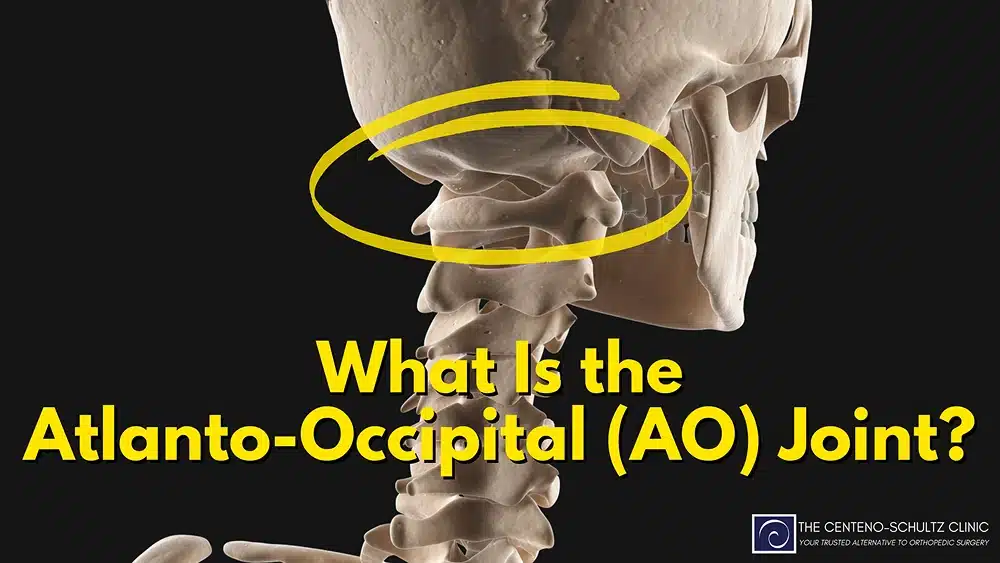 <p>-Occipital condyle and superior articular surface</p><p>-Synovial joint has no intervertebral disc. </p><p>-Condyloid creates flexion/extension and lateral flexion. </p>