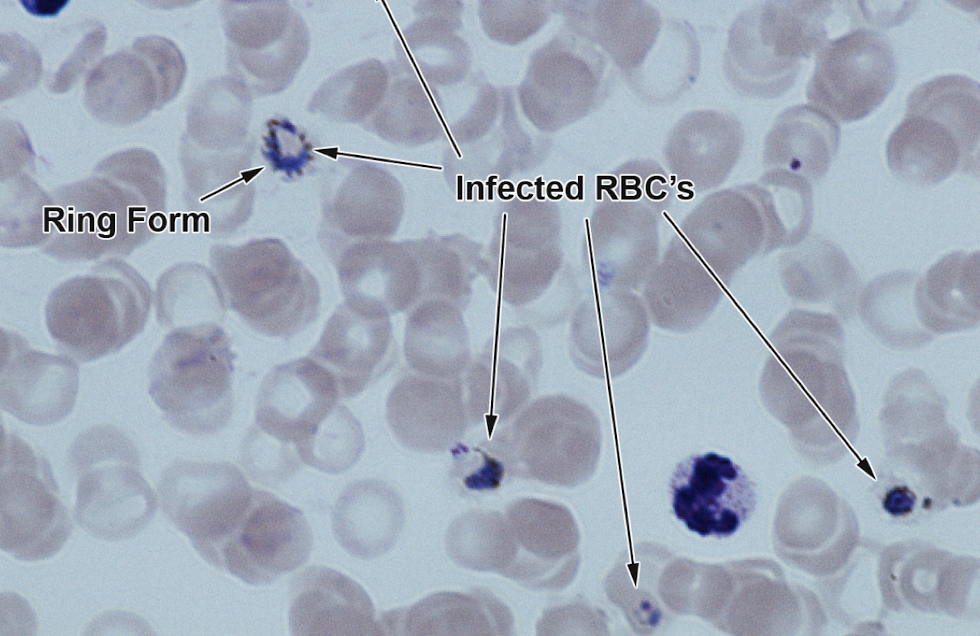 <p>Transmitted by mosquitoes, causes Malaria </p>