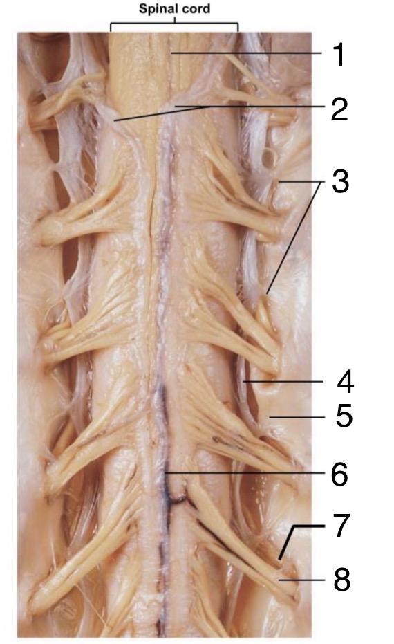<p>Label the parts of the anterior Spinal Cord</p>
