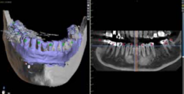 <p>Digital Imaging and Communication In Medicine (DICOM)</p>