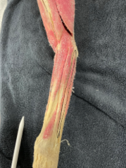 <p>Identify the muscle</p>