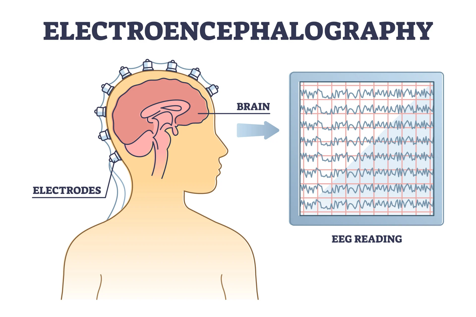 <p>electroencephalogram = </p>