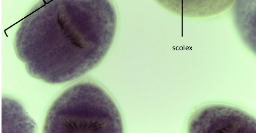 <p>name 1 way we can get infected with dog tapeworm </p>