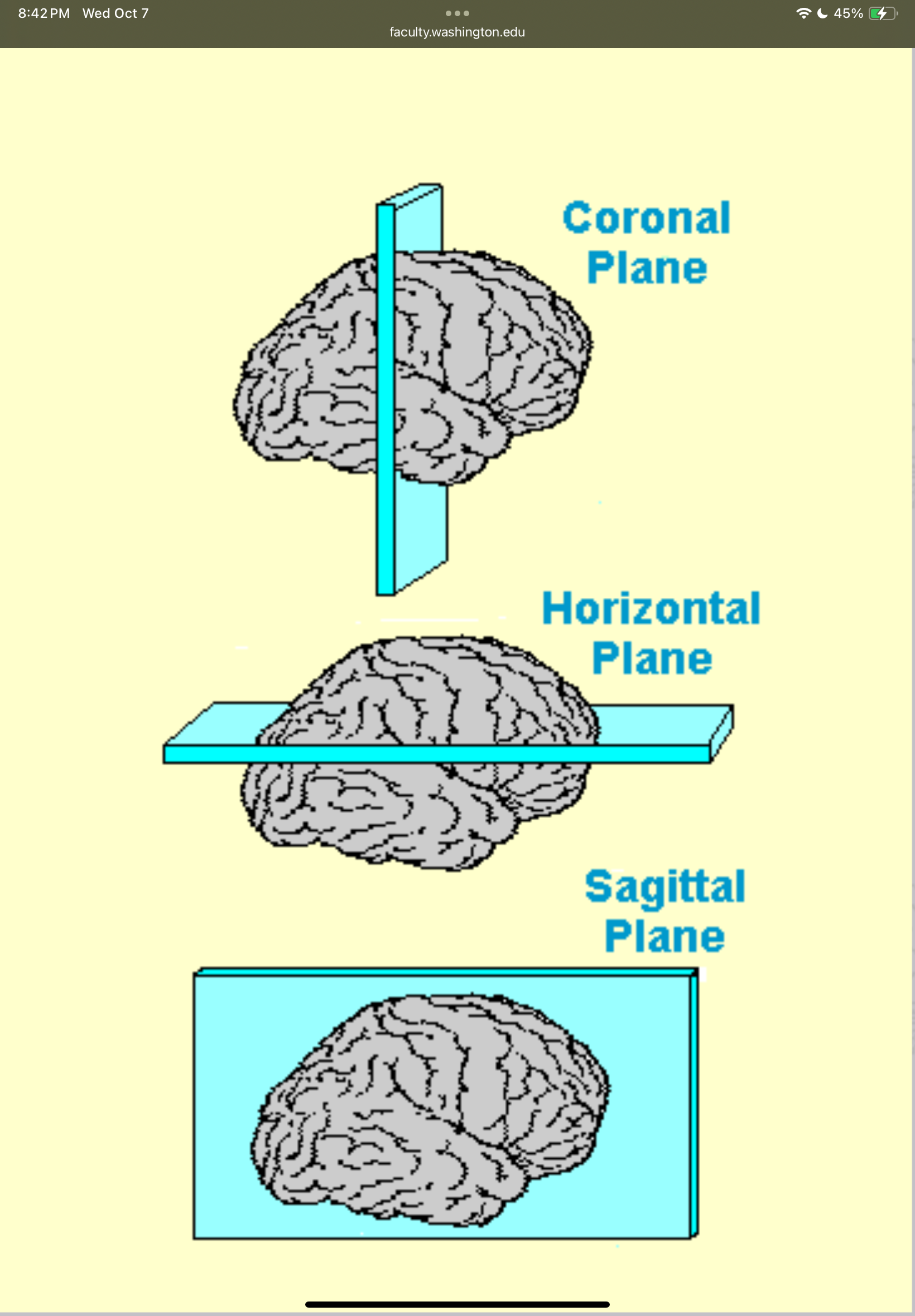 <p>A vertical brain slicing plane running from ear to ear that divides the brain into anterior (front) and posterior (back) sections.</p>