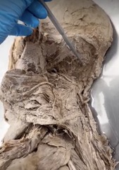 <p>Name the muscle</p><p>- minors cant get in the club (triangle)</p>