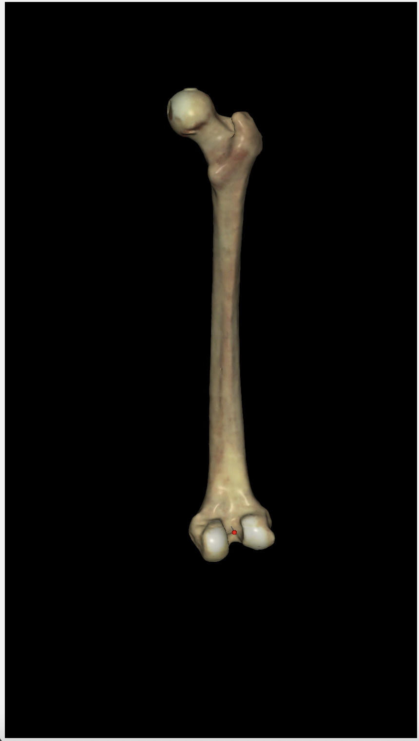 <p>is this the left or right femur? (posterior view)</p>