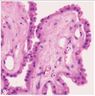 <p>columnar cells—similar functions to epithelial cells; lines central canal of spinal cord &amp; ventricles of brain</p>