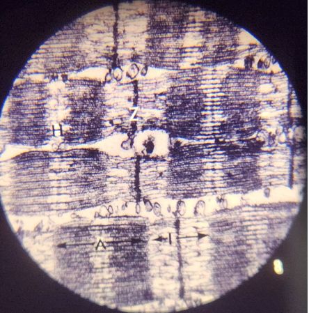 term image