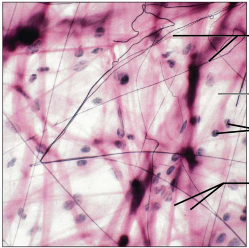 <p>Gel-like matrix with all three fiber types; cells: fibroblasts, macrophages, mast cells, and some WBCs. Wraps and cushions organs; its macrophages phagocytize bacteria; plays important role in inflammation; holds and conveys tissue fluid.; edema. Supports and binds other tissue. Widely distributed under epithelia of body, e.g., forms lamina propria of mucous membranes; packages organs; surrounds capillaries.</p>