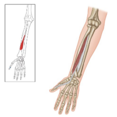 <p>What is the insertion of the flexor pollicis longus?</p>