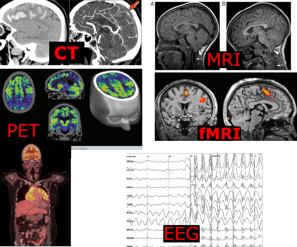 <ul><li><p>X-ray of brain structure, not very detailed and doesn’t show activity</p></li></ul><p></p>