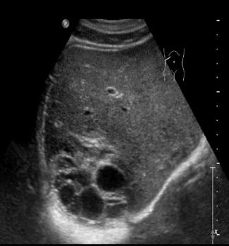 <p>Identify this image. </p>