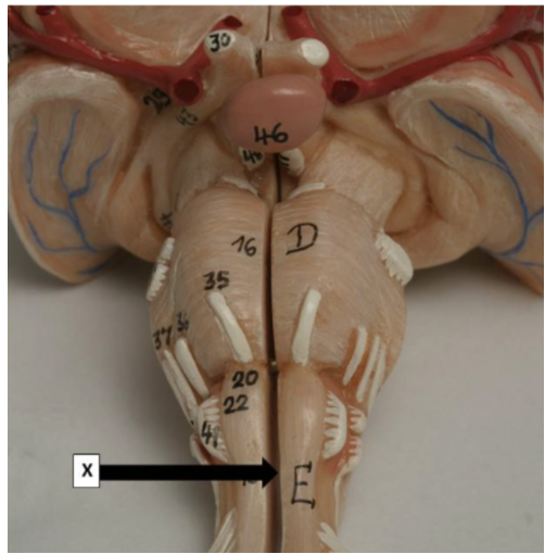 <p>Which one statement is correct concerning point X?</p><p>It is the superior cerebellar peduncle which carries information from the cortex to spinal cord.</p><p>It is the gracile fasciculus and receives information from the upper limbs.</p><p>It is the gracile fasciculus and receives information from the lower limbs.</p><p>It is the point where pyramidal fibres of the corticospinal tract may cross over.</p><p>Is where the olivary nucleus is contained</p>