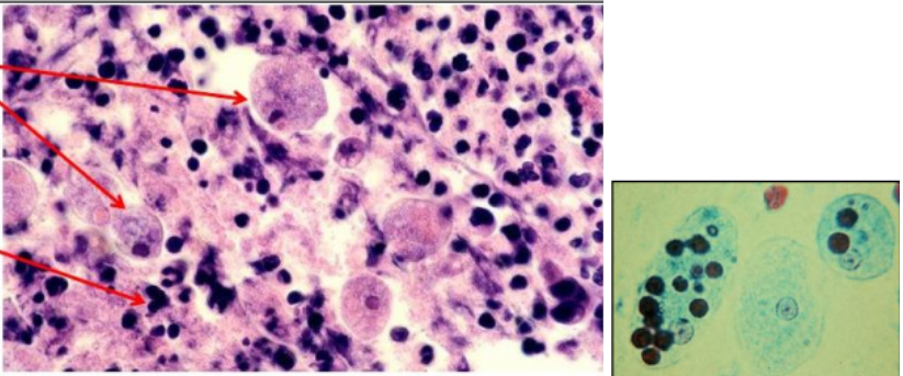<p>Qual método diagnóstico permite a identificação desse parasita?</p>