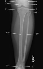 <p>Identify the anatomy indicated by the number (9).</p>