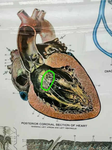 term image