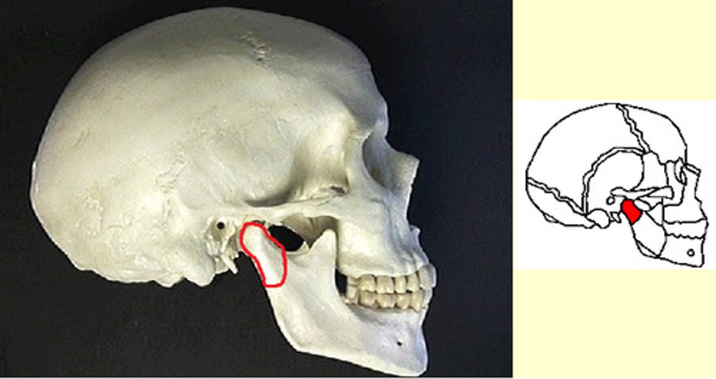 <p>ID structure circled in red</p>
