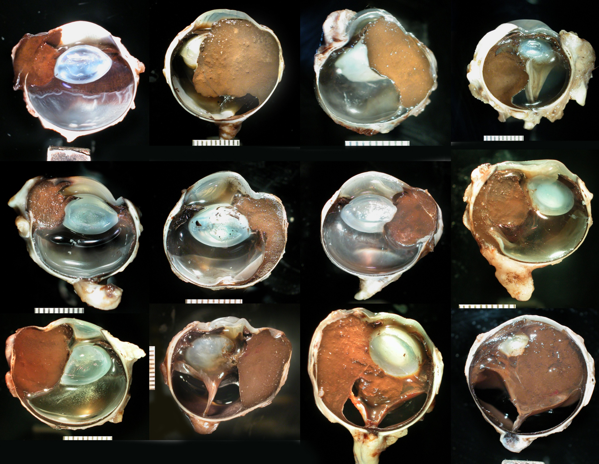 <ul><li><p>anterior uveal tract — most common</p></li><li><p>choroid</p></li><li><p>epibulbar/limbar</p></li></ul><p></p>