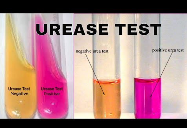 <ul><li><p><strong>Purpose: </strong>To determine whether bacteria produce urease (a protease).</p></li><li><p><strong>Content:</strong> Urea</p></li><li><p><strong>Detection method: </strong>pH indicator. When bacteria secrete urease, it hydrolyzes urea into ammonia (alkaline) and carbon dioxide changing the color of the media from yellow to pink</p></li><li><p><strong>Original test color/physical appearance: </strong>Yellow slant</p></li><li><p><strong>Positive result appearance: </strong>Media turned pink</p></li><li><p><strong>Positive result interpretation: </strong>Urease was produced, breaking down the urea to form ammonia. This raised the pH (alkaline), causing the phenol red indicator to turn pink</p></li><li><p><strong>Negative result appearance: </strong>Media stayed yellow</p></li><li><p><strong>Negative result interpretation: </strong>Urease was not produced. Therefore, urea was not hydrolyzed, no ammonia was produced, and pH did not increase</p></li><li><p><strong>Reagents: </strong>None. Media already contains pH indicator (phenol red)</p></li></ul><p></p>