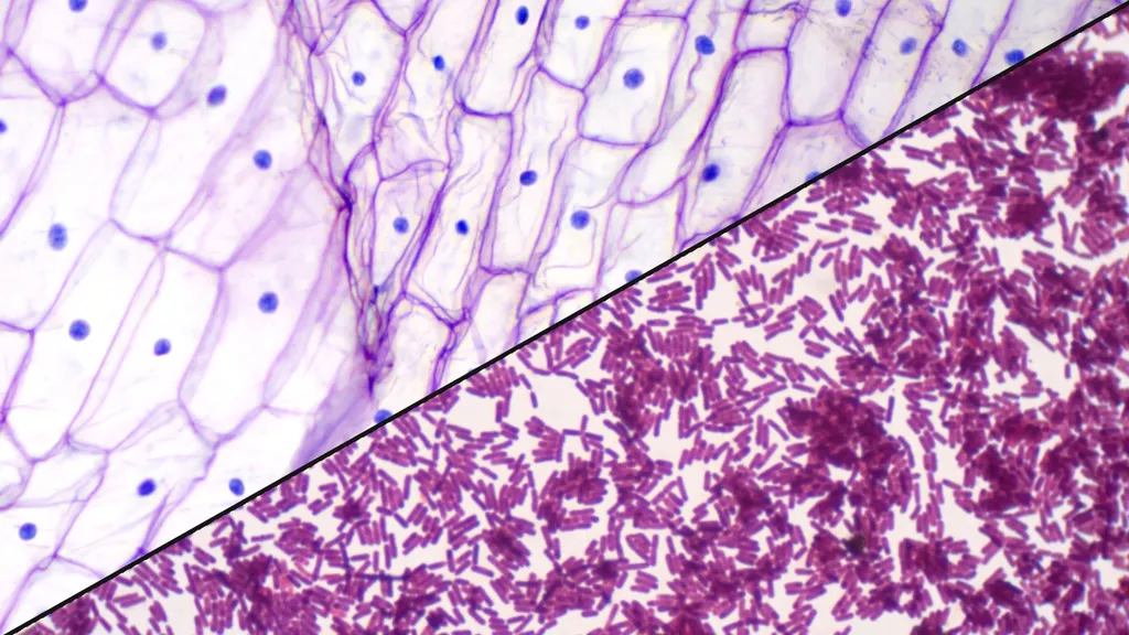 <p>eukaryote has nucleus</p>