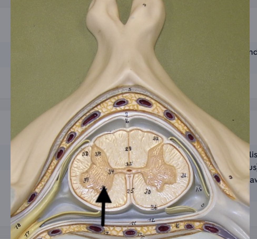 <p>location of somatic (lower) motor neurons within all spinal cord segments</p>