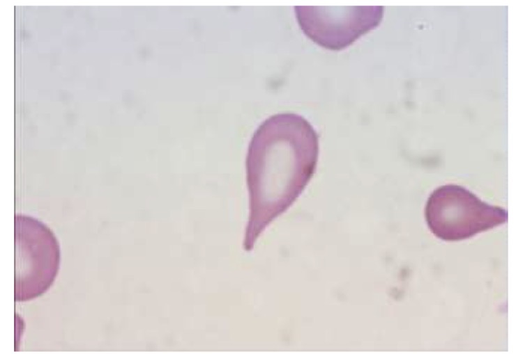 <p>Name this RBC</p>