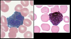 <p>Dark granules- cannot see the nucleus </p><p>least abundant </p><p>allergic reactions</p>