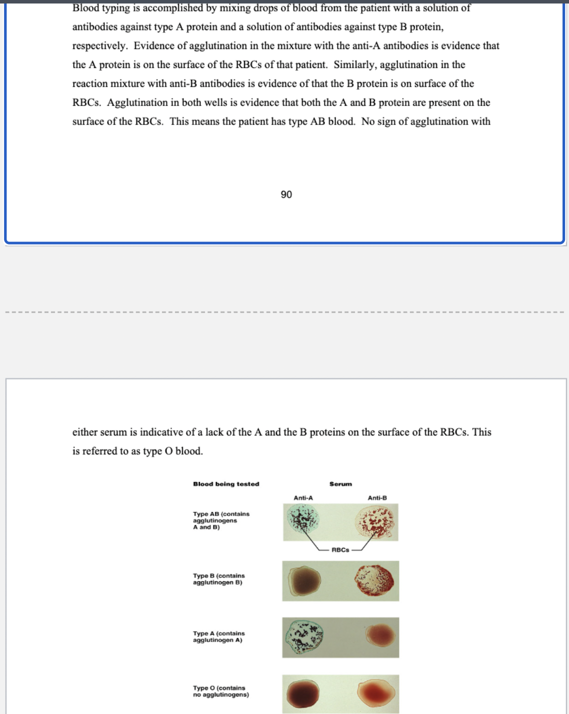 <ul><li><p>involves RBCs and is used in <em>blood typing</em>: </p><ul><li><p>specific interaction btwn antibodies against the various antigens on the surface of RBCs</p></li><li><p>blood typing is accomplished by mixing blood droplets with a solution of antibodies against type A protein and a solution of antibodies against B protein, respectively</p></li></ul></li></ul><p>Normally, persons will have a certain amount of antibody against the ABO antigens that they do not carry. The reasons for the presence of this antibody have never been discerned. If the wrong type of blood is given to a patient, the antibodies in their serum will bind to and cause the destruction of these newly introduced RBCs in the transfusion. When these RBCs are destroyed, chemicals are released that increase vasodilation and vascular permeability. This results in rapid loss of fluids into the tissues on a systemic basis and a <strong>systemic loss of vascular tone. Together, these two changes in the blood vessels will send the patient into </strong>shock. Use of the rapid blood typing reaction can eliminate blood type mismatches.</p><p></p>