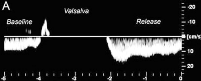 <p><strong>normal or abn</strong></p>