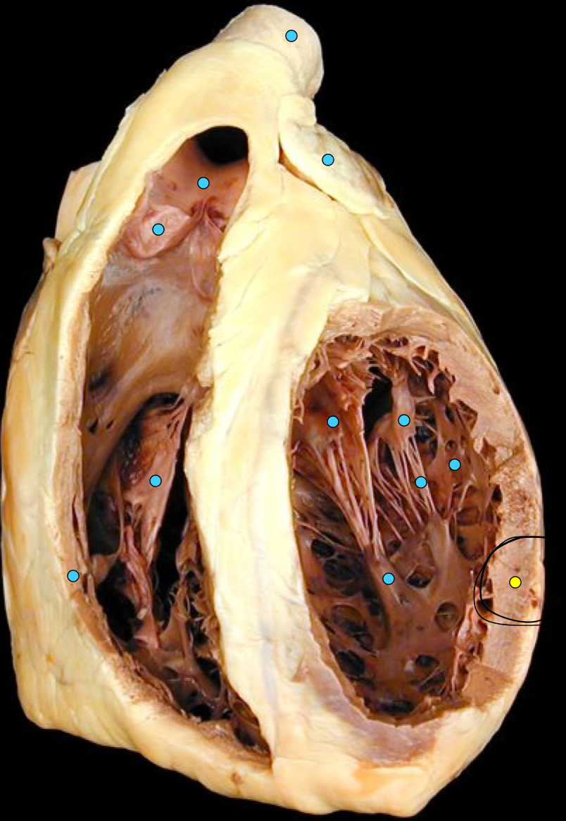term image