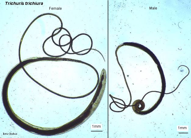 <p>Trichuris trichiura Female Anatomy</p>