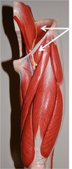 <p>A strong band of connective tissue that runs from the anterior superior iliac spine (ASIS) of the hip bone to the pubic tubercle. It forms the lower border of the abdominal wall and separates the abdomen from the thigh.</p>