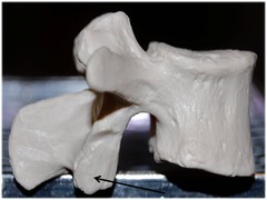 <p>Name this specific part of the lumbar vertebrae. and direction</p>