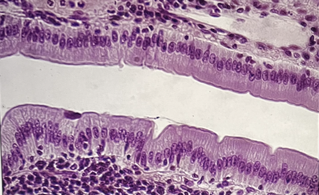 <p>Identify this tissue</p><p>a. stratified cuboidal epithelial tissue</p><p>b. simple cuboidal epithelial tissue</p><p>c. simple columnar epithelial tissue</p><p>d. pseudo-stratified ciliated columnar epithelial tissue</p>