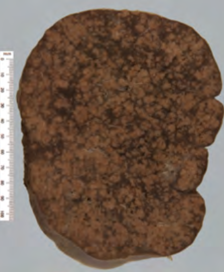 <p>Identify the POT</p>