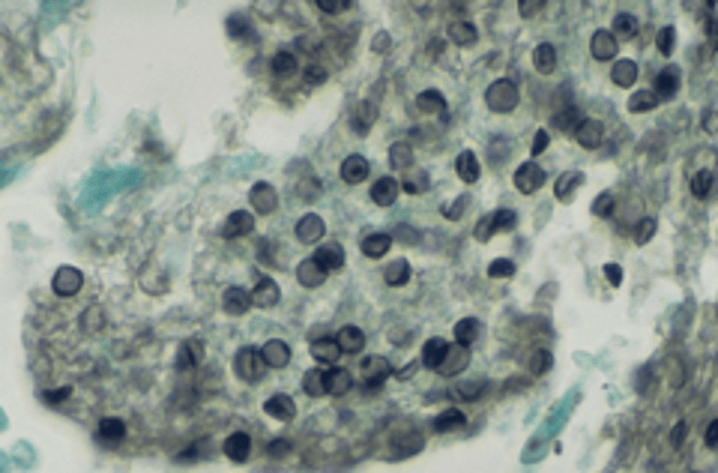 <p>pneumocystis (brown)</p>