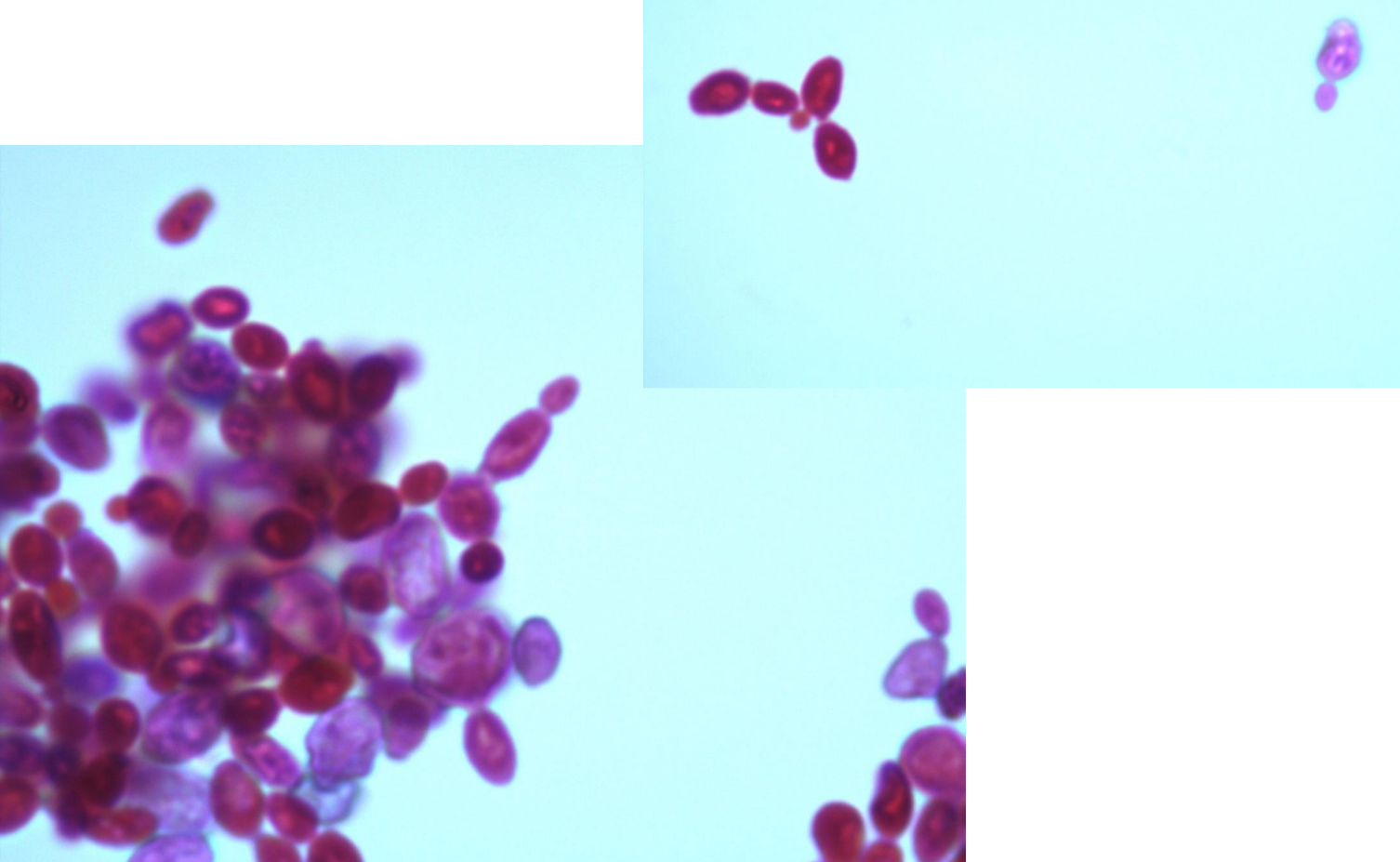 <p>*note budding cells </p>