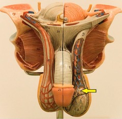 <p>Identify this structure.</p>