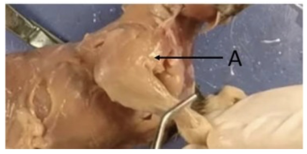 <p>name the muscle at the pointer tip</p>