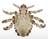 <ul><li><p>pubic louse </p></li><li><p>Phthiriasis</p></li></ul><p></p>