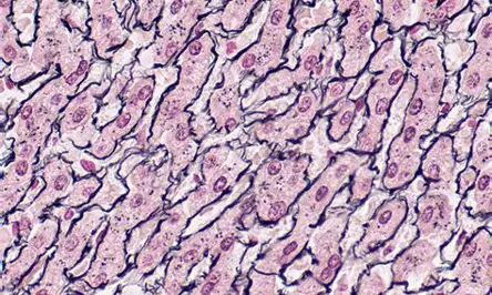 <p>Reticular Tissue</p>