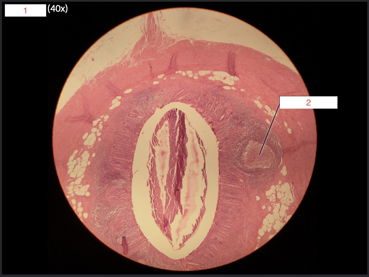 <p>1- What is this slide?</p>