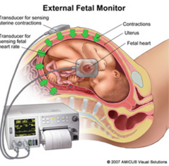 <p>to detect early signs of hypoxia and acidosis and intervene to preserve fetal health</p>