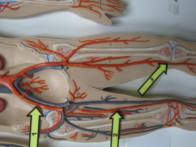 <p>Identify The Vessel 1, 2 and 3?</p><p>Lab Image 3-10</p>