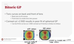 <p>What is a bitoric GP?</p>